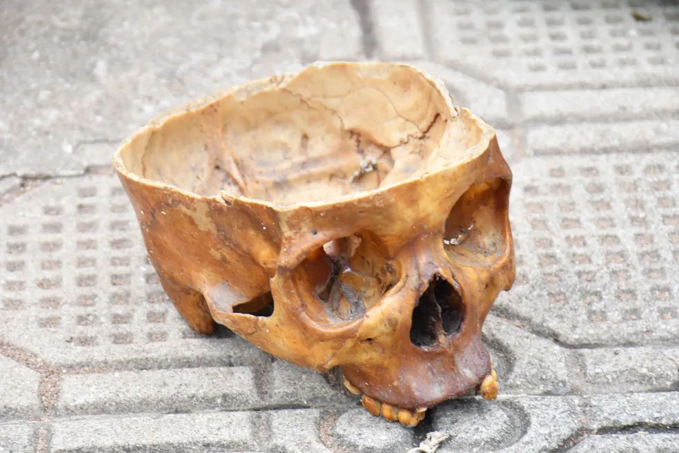 Crânio humano é encontrado em Governador Valadares — Foto: Júnior Nogueira